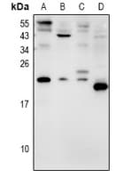 Polyclonal Rabbit anti-Human AVP / ADH / Vasopressin Antibody (WB)