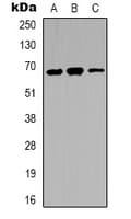 Polyclonal Rabbit anti-Human IRAK3 / IRAKM / IRAK-M Antibody (C-Terminus, IHC, IF, WB)