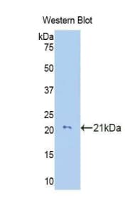 COL8A2 / Collagen VIII Antibody (aa533-698, APC)