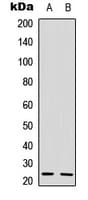 IL22 Antibody (C-Terminus)