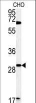 LHFPL2 Antibody (aa196-223)