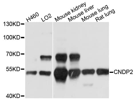 CNDP2 Antibody