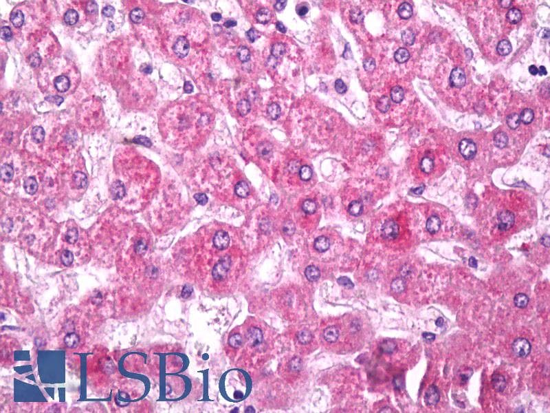 IHC-plus™ PLXNB1 / Plexin-B1 Antibody