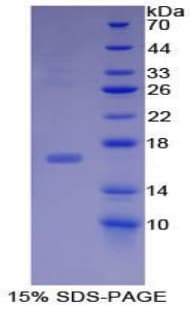 Mouse BMP15 Protein (Recombinant His-T7)