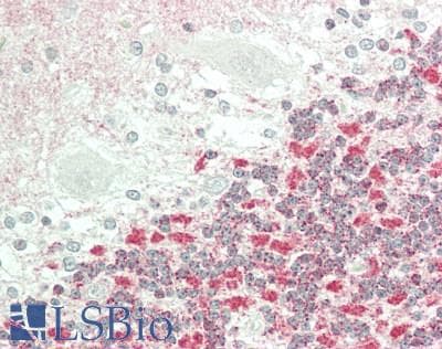 IHC-plus™ Polyclonal Rabbit anti-Human KCNMB2 Antibody (aa137-186, IHC, WB)