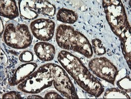 IHC-plus™ ACAA2 Antibody (clone 1C10)