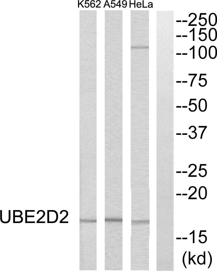 UBE2D2 / UBCH5B Antibody