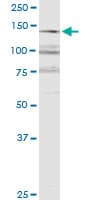 Monoclonal Mouse anti-Human RERE Antibody (clone 2F2, WB)