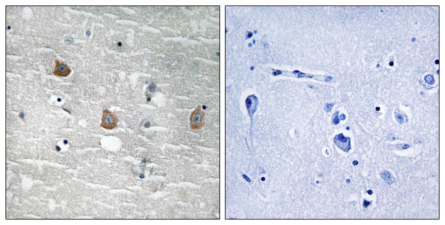 TOB1 / TOB Antibody (phospho-Ser164)