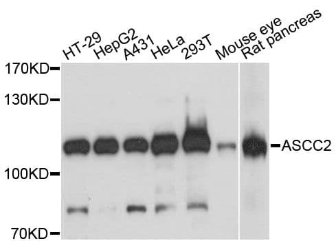 Polyclonal Rabbit anti-Human ASCC2 Antibody (WB)