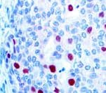 CDKN1A / WAF1 / p21 Antibody (clone DCS-60.2)