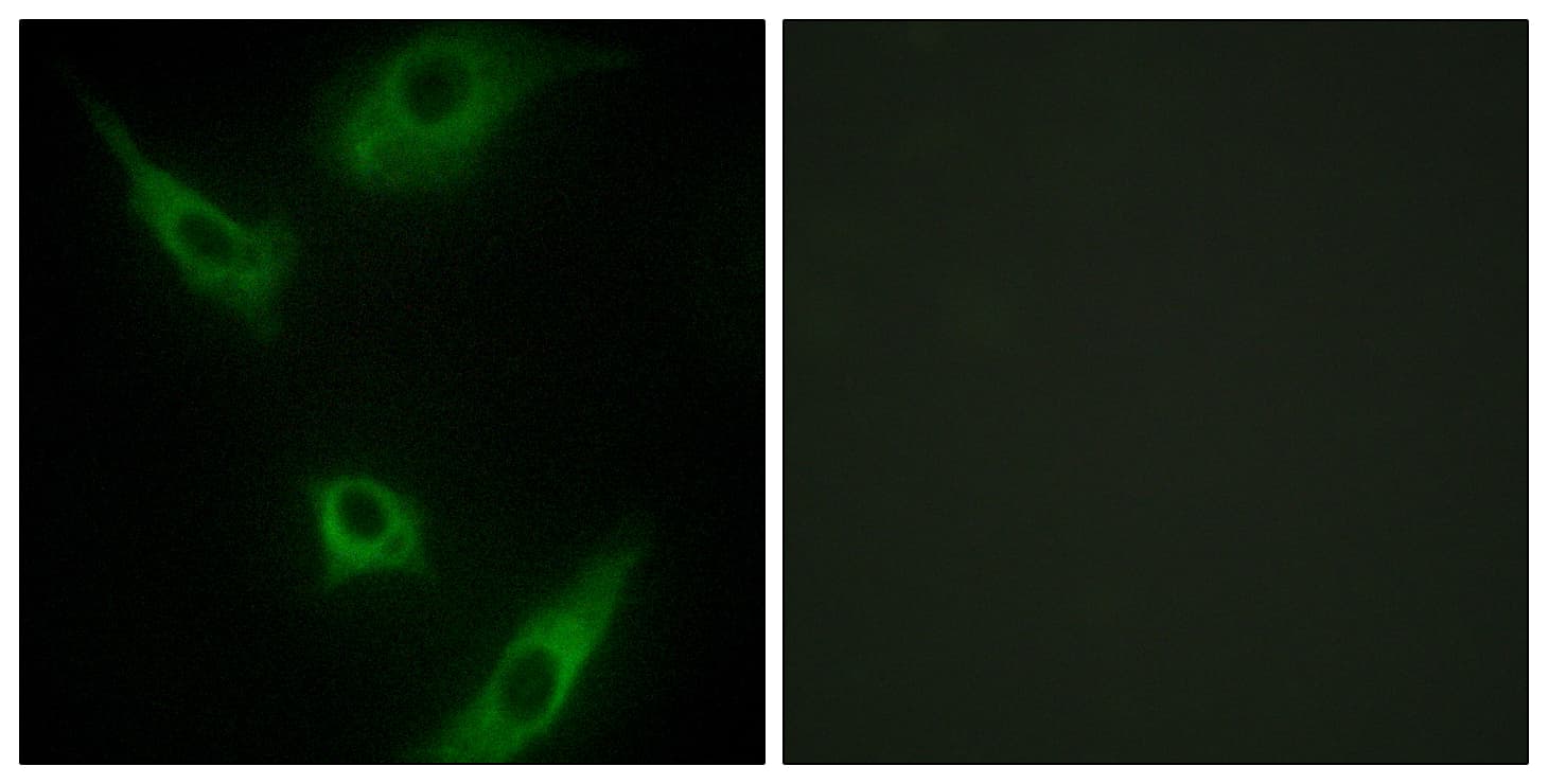 MAP3K1 / MEKK1 Antibody (aa181-230)