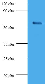 CHRNA1 Antibody