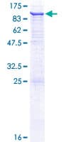 Human VPS45 Protein (Recombinant GST)