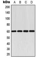 Polyclonal Rabbit anti-Human AKT1 Antibody (C-Terminus, IHC, WB)