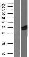 Human MLF1 Protein (Over-Expression Lysate Myc-DDK (Flag))