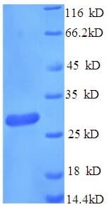 Mouse CD163 Protein (Recombinant His)