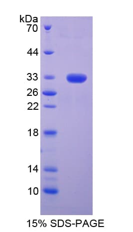 Rat Basigin / Emmprin / CD147 Protein (Recombinant His-T7)