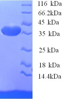 Mouse SPP1 / Osteopontin Protein (Recombinant His)