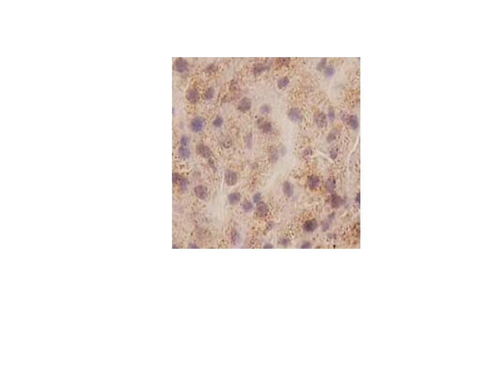 IL1A / IL-1 Alpha Antibody
