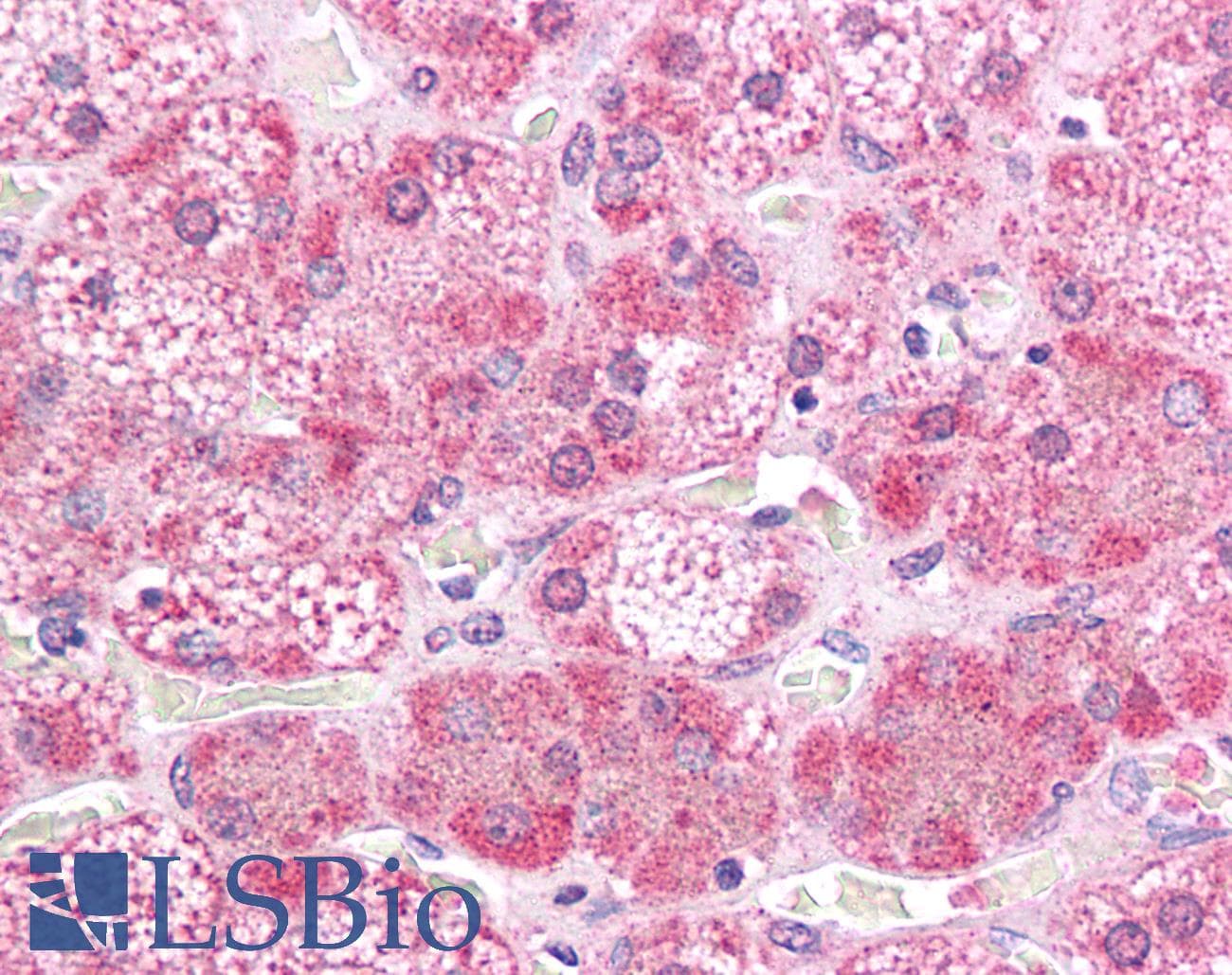 Polyclonal Rabbit anti-Human MAP2K2 / MKK2 / MEK2 Antibody (N-Terminus, IHC, WB)