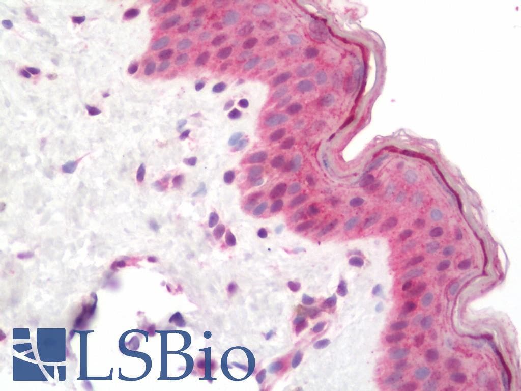 IHC-plus™ HDAC4 Antibody (aa1052-1084)