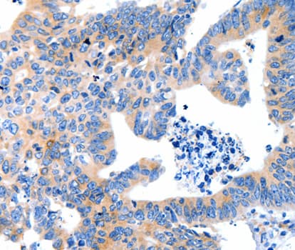 IHC-plus™ LRPAP1 Antibody