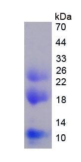 Rat MMP9 / Gelatinase B Protein (Recombinant His, N-Terminal)