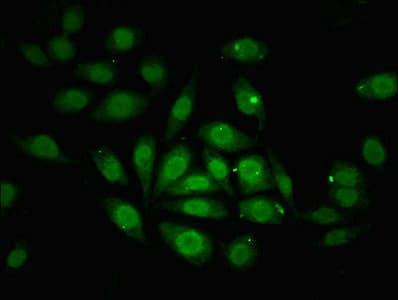 ZNF366 Antibody