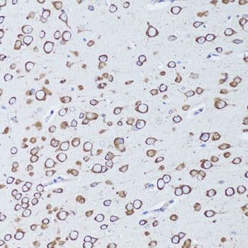 Polyclonal Rabbit anti-Human TNFRSF11A / RANK Antibody (IHC, WB)