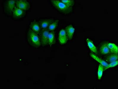 RAB27A / RAB27 Antibody
