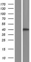 GBGT1 Protein (Over-Expression Lysate Myc-DDK (Flag))