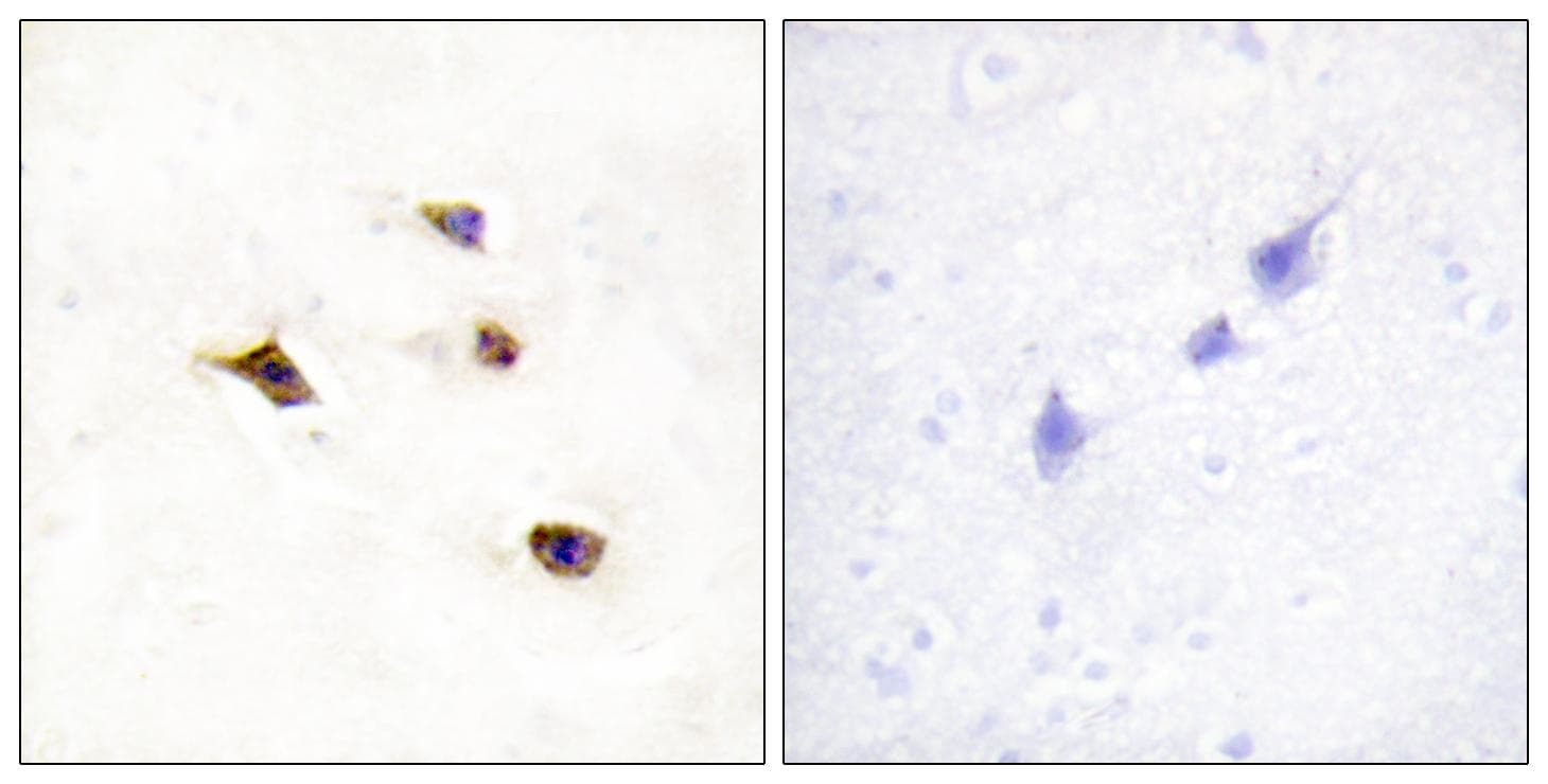 Polyclonal Rabbit anti-Human IP6K3 Antibody (IHC, WB)