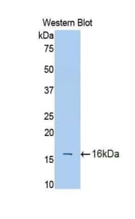 CDw218a / IL18R1 Antibody (aa147-255)