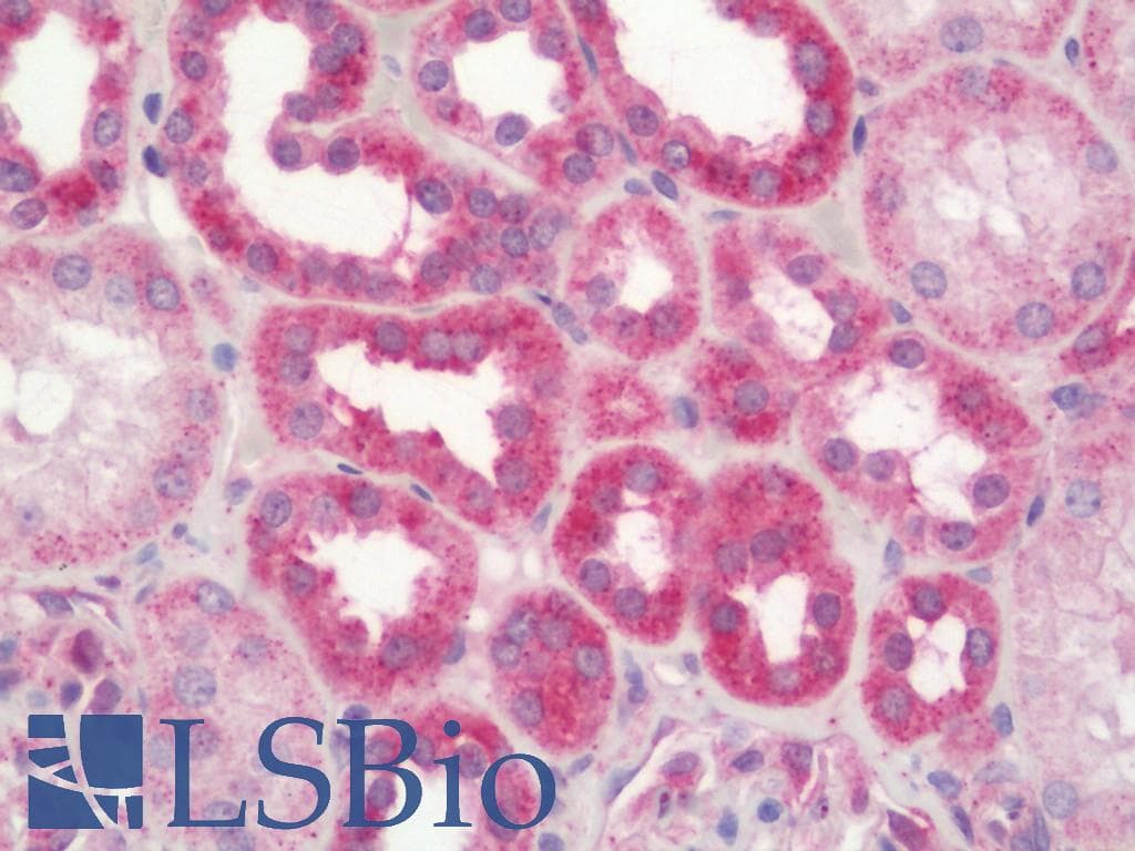 IHC-plus™ Polyclonal Rabbit anti-Human EGFR Antibody (Ser1070, IHC, WB)
