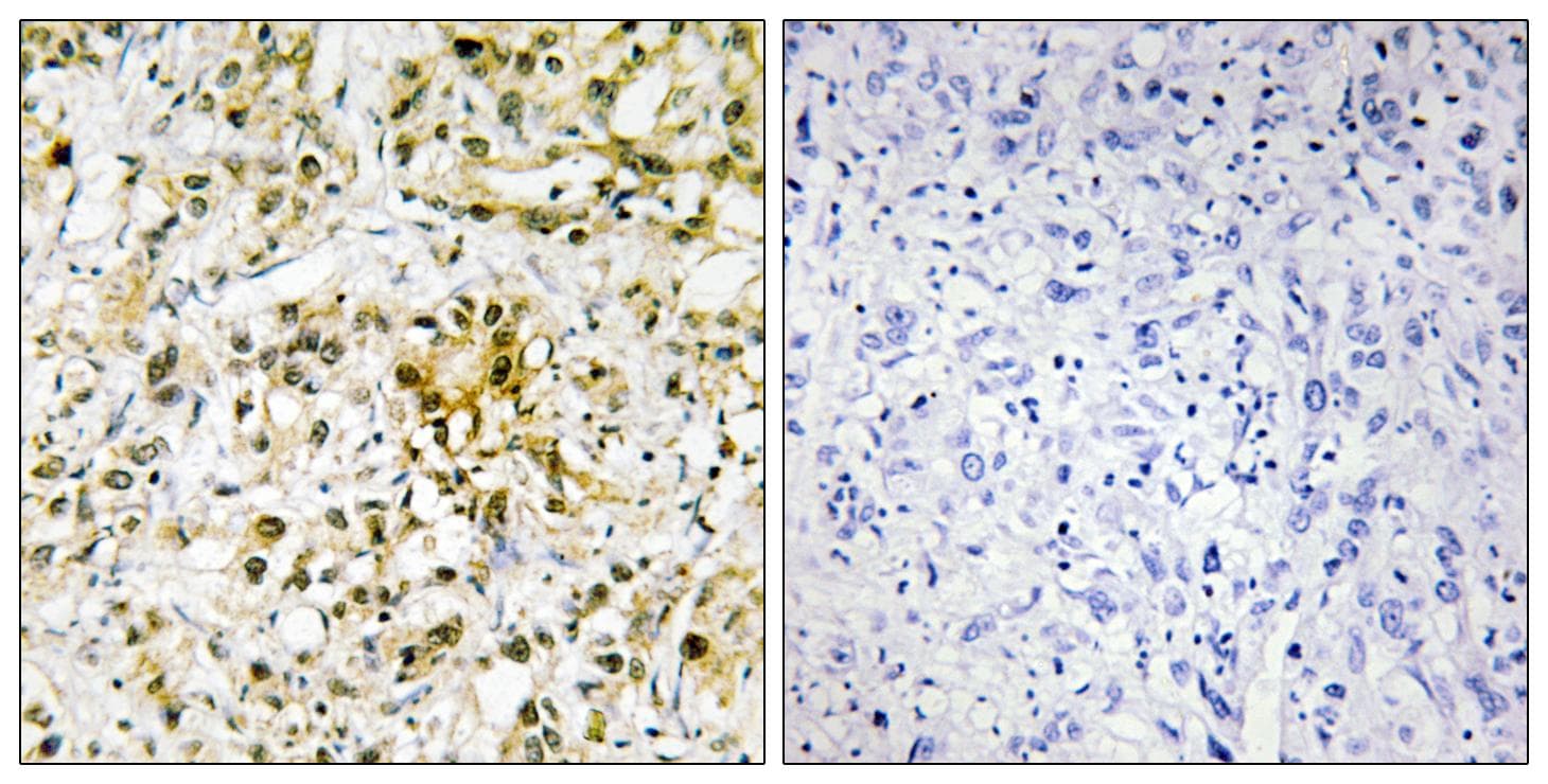 Polyclonal Rabbit anti-Human GAL4 / Galectin 4 Antibody (IHC, WB)