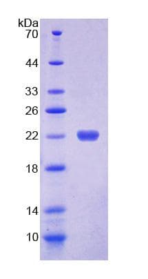 Human DKC1 / Dyskerin Protein (Recombinant His-T7)