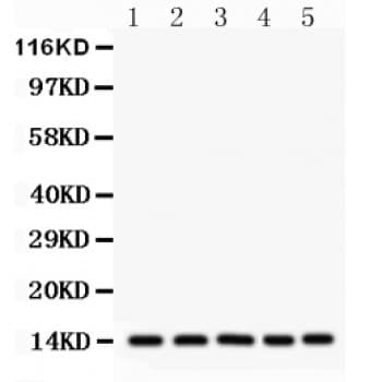 FABP1 / L-FABP Antibody (aa6-36)