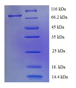 Human ERBB2 / HER2 Protein (Recombinant 6His, N-terminus)