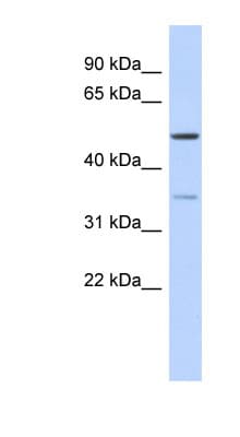 CETP Antibody (aa395-444)