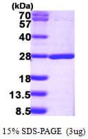 Human NUDT16L1 Protein (Recombinant His)
