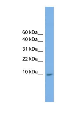 KRTAP23-1 Antibody (C-Terminus)