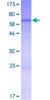 Human MTERF4 / MTERFD2 Protein (Recombinant GST)