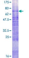 Human SLC2A4 / GLUT-4 Protein (Recombinant GST)