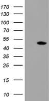 TDO2 Antibody (clone OTI1B1)