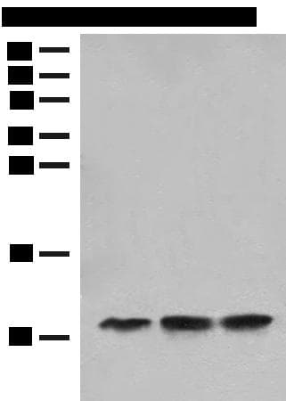 Polyclonal Rabbit anti-Human ATPase Subunit G / ATP5L Antibody (WB)