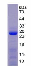 Mouse MMP1 Protein (Recombinant His, N-Terminal)