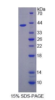Mouse CAPN5 / Calpain 5 Protein (Recombinant His-T7, N-terminus)