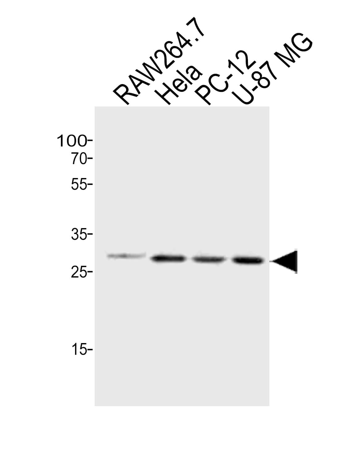 Polyclonal Rabbit anti-Human AQP4 / Aquaporin 4 Antibody (WB)