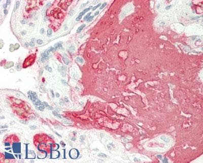 IHC-plus™ FGG / Fibrinogen Gamma Antibody